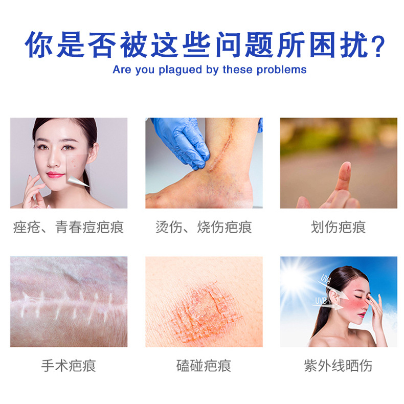 舒疤宁凝胶2